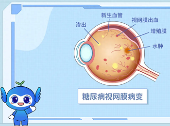 糖尿病视网膜病变如何预防和治疗？