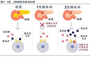 糖尿病肾病的发生机制是什么？