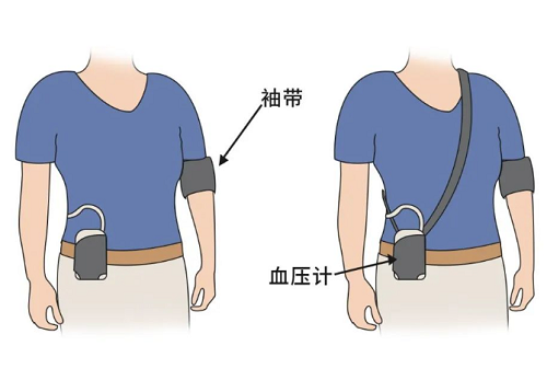 动态血压监测的重要性是什么？