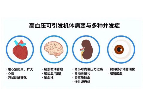 高血压与心脏病的关系是什么？