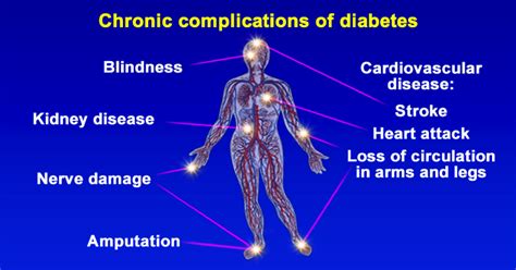Chronic complications of diabetes