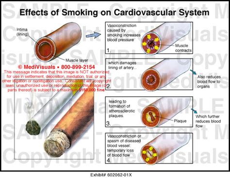 Effects of Smoking on Cardiovascular System …