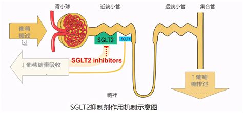 跨界明星降糖药——SGLT-2抑制剂的解读 