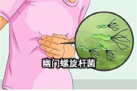 幽门螺杆菌（上）检测与治疗