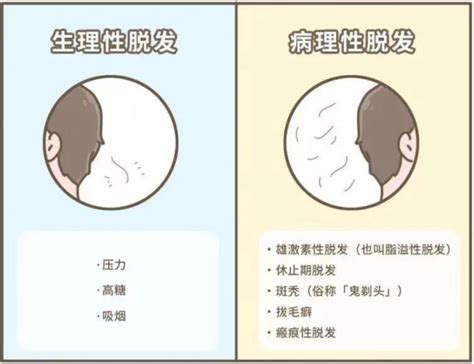 防脱发的方法有哪些？