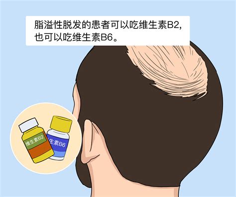 脂溢性脱发吃维生素B2还是B6-有来医生