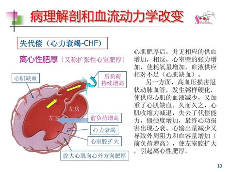 高血压性心脏病的超声诊断要点_w… 51wendang.com