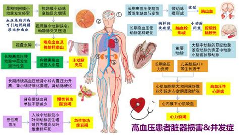 一图概览| 高血压对各脏器的危害