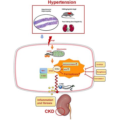 STING/ACSL4 axis-dependent ferroptosis and inflammation pro…