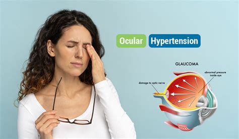 Ocular Hypertension: Symptoms, Causes, Prevention, Risk Factors