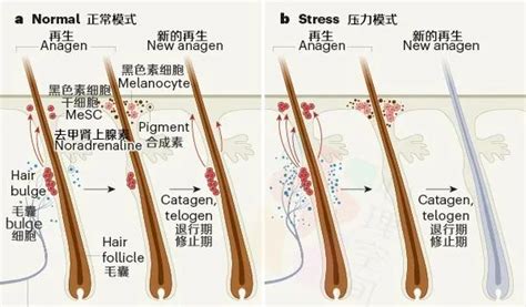熙语白发转黑成功案例